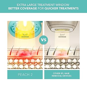 FOREO PEACH 2 IPL脱毛デバイス Amazon.com: FOREO PEACH 2 IPL Hair Removal Device – Quick